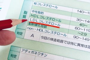 投稿についてもっと詳しく 保護中: 女性必見！LDLコレステロール「だけ」高い原因とその改善方法は？